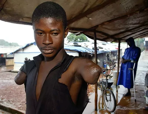 A man with amputed arms is seen in a camp in Sierra Leone.