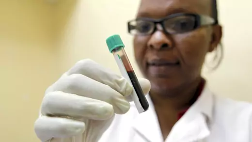 Mishi Mohammed, a phlebotomist, holds a blood sample from a woman to test for HIV at the Mater Hospital in Kenya, September 10, 2015. 
