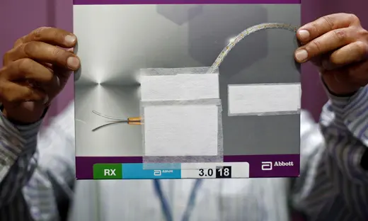 A staff member shows a heart stent inside a store at a New Delhi hospital.