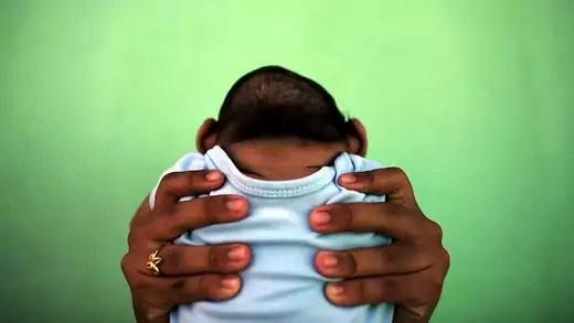 Un bebé nacido con microcefalia es retenido por su madre frente a su casa en Olinda, Brasil, en febrero de 2016.