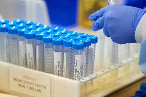 A lab at Methodist Dallas Medical Center prepares viral transport media for samples before collecting samples for coronavirus disease (COVID-19) in Dallas, Texas.
