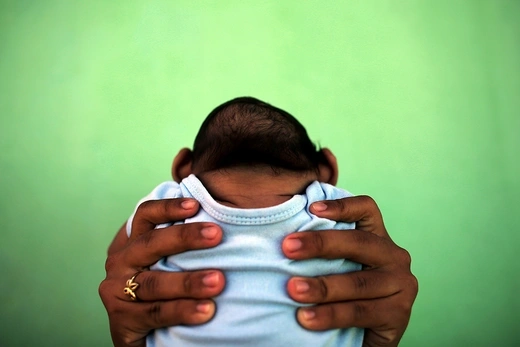 A baby born with microcephaly is held by his mother in front of their home in Olinda, Brazil, in February 2016.