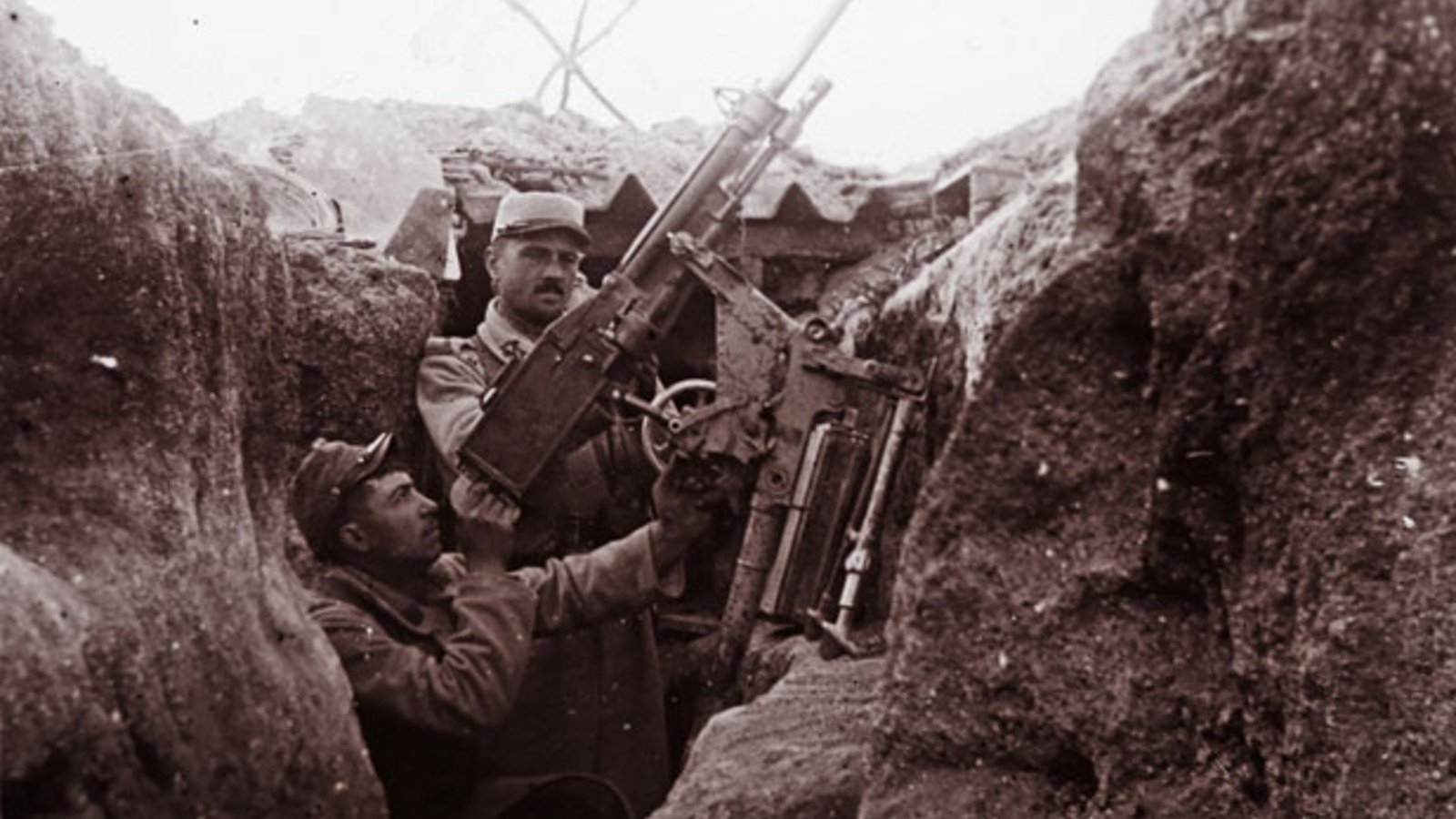 WWI photos show realities of injured soldiers in hospital