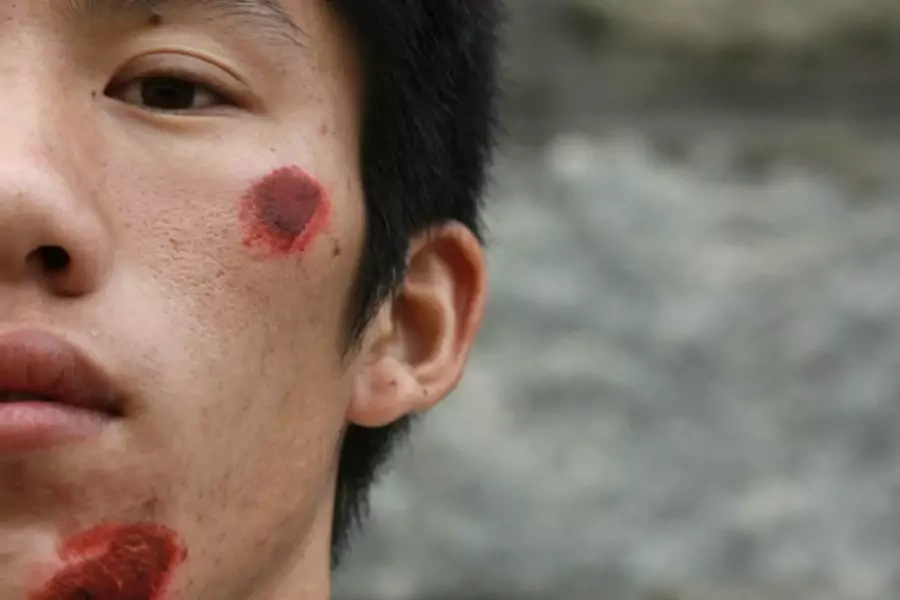 A wounded villager from Wukan is seen after a riot with the police the day earlier on September 23, 2011.
